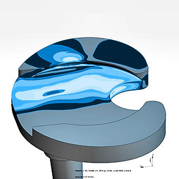 Implant Testing - FEA Tibiakomponente - ASTM F3334